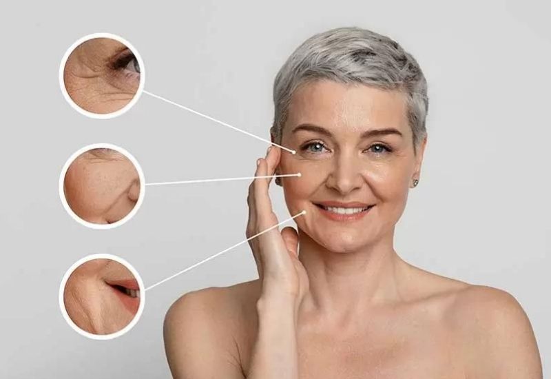 chăm sóc da giảm nếp nhăn