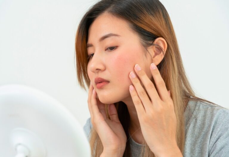 cách chăm sóc da mặt mỏng yếu