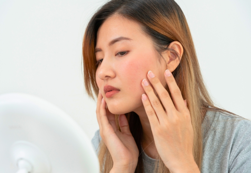 cách chăm sóc da mặt mỏng yếu