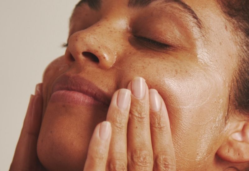 nặn mụn xong nên chăm sóc da như thế nào