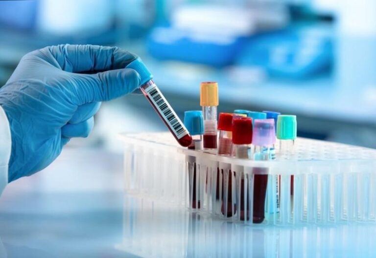 xét nghiệm vi chất dinh dưỡng