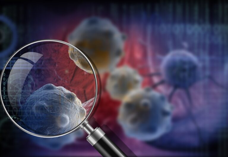 béo phì gây ung thư