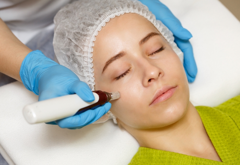 chăm sóc da sau lăn kim