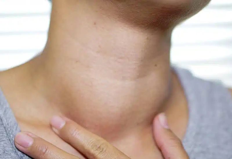 u tuyến giáp có uống được nmn không