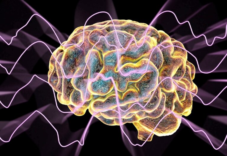 rối loạn thần kinh não